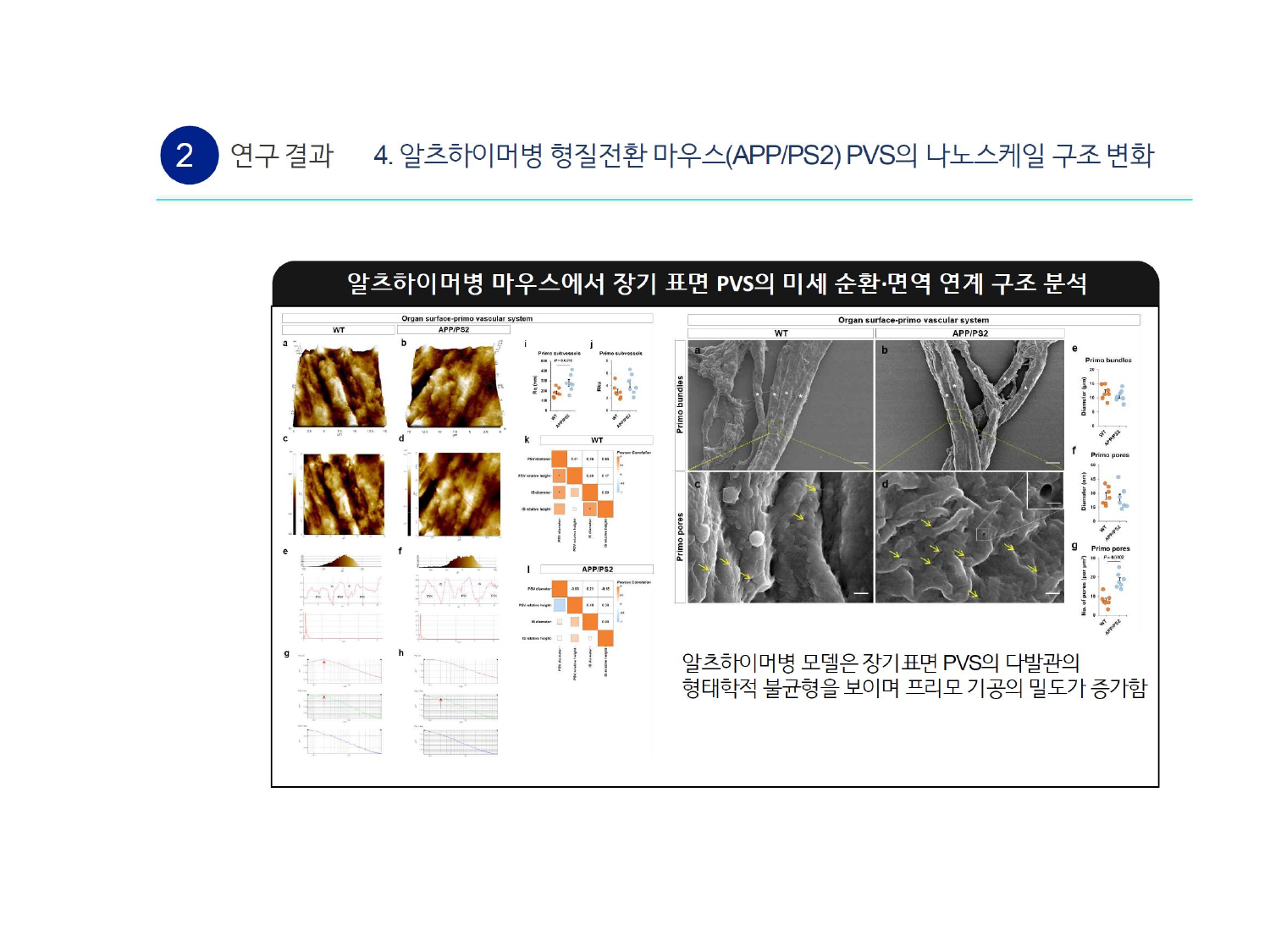 Nanoscale structural changes in APP/PS2 long-term surface PVS